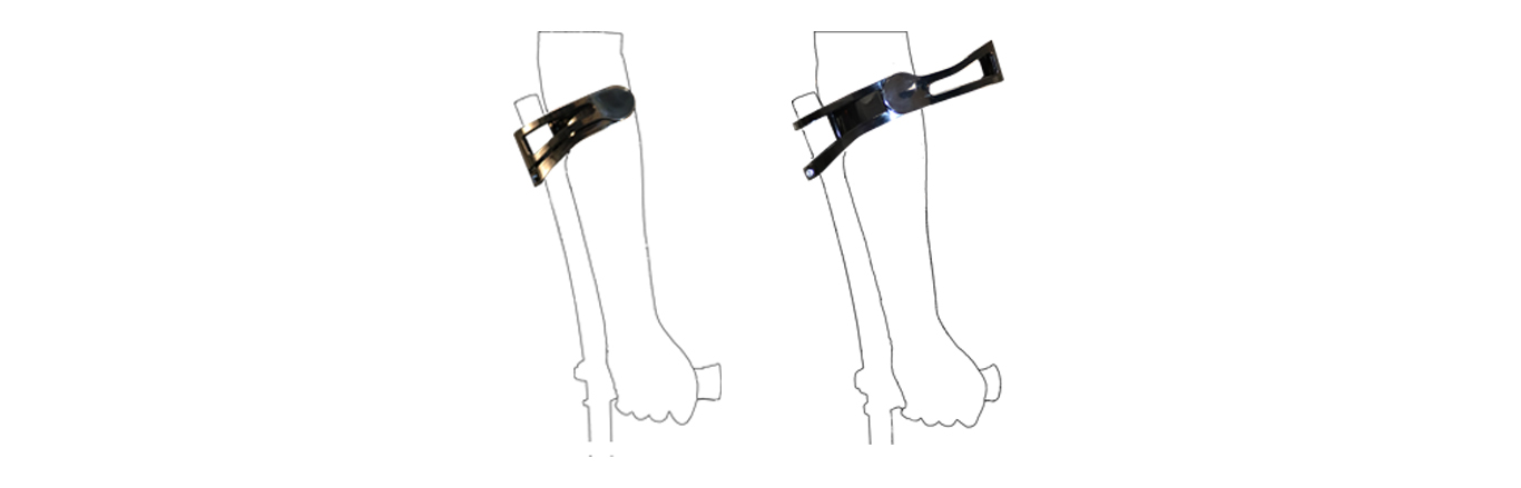How to wear the closed cuff for INDESmed crutches